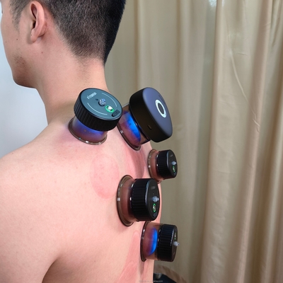 Fitdash Cupping Infrarosso Cupping elettrico a vuoto Massaggio corpo Coppe Cupping Machine Vacuum Therapy