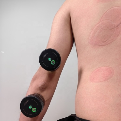 Fitdash Cupping Infrarosso Cupping elettrico a vuoto Massaggio corpo Coppe Cupping Machine Vacuum Therapy