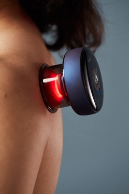 Macchina elettrica intelligente per la cupping per la terapia a infrarossi con resistenza di aspirazione di 60-0 kPa