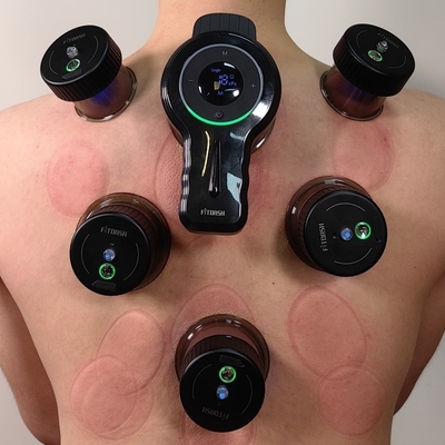 Fitdash Ricaricabili Smart Cupping Cups L'aggiunta perfetta alla vostra routine di benessere