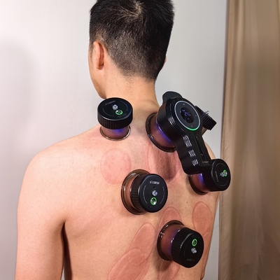 Cupping di respirazione intelligente con -10kPa -60kPa Forza di aspirazione e 3.7V/150mAh Cup