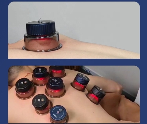 Cupping di respirazione intelligente con -10kPa -60kPa Forza di aspirazione e 3.7V/150mAh Cup