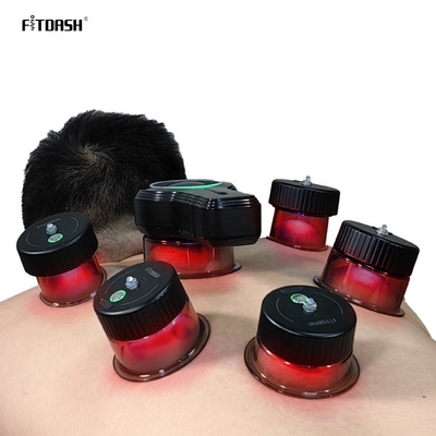 Terapia intelligente con cupping a vuoto per migliorare la resistenza di aspirazione del flusso sanguigno -10 kPa -60 kPa