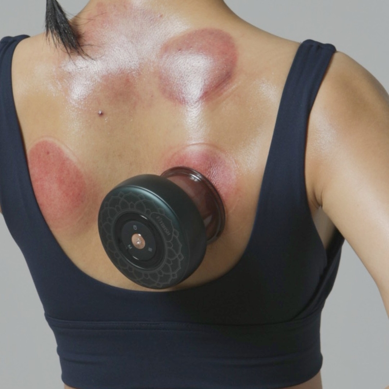 Fonte di alimentazione carica strumento di massaggio Gua Sha professionale per la riduzione della cellulite ABS P