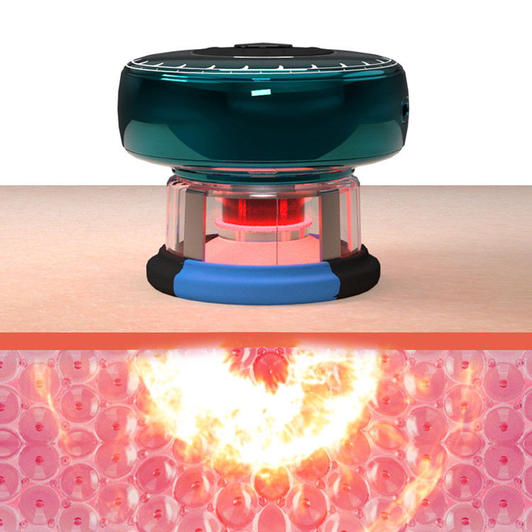 Fitdash TENS Smart Vacuum Copper Ricaricabile e facile da caricare per migliorare la circolazione sanguigna
