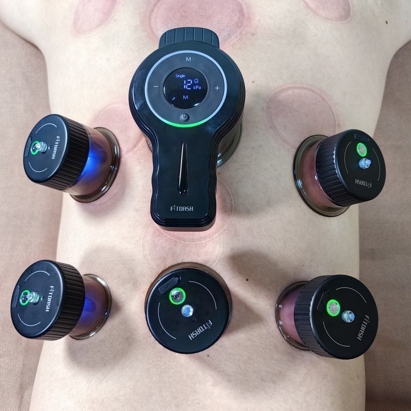 Terapia di cupping per respirazione intelligente con aspirazione e vuoto